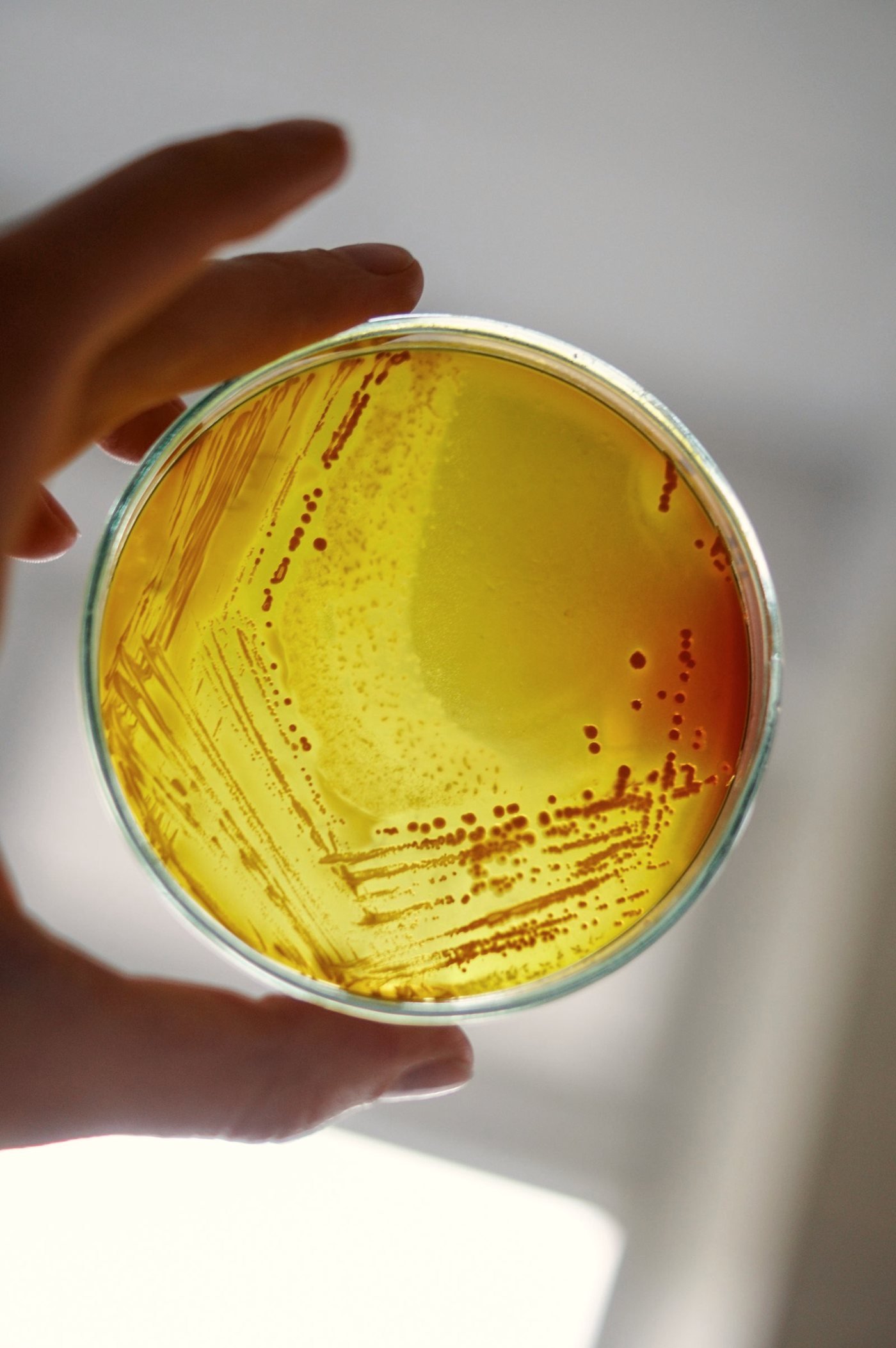 A culture plate held up to the light for analytical inspection